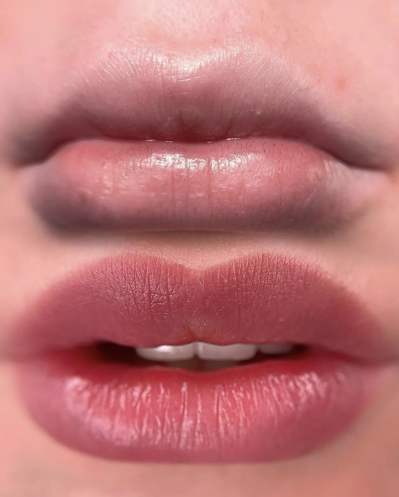 IMG 3477 82c51bf2 Permanent Makeup